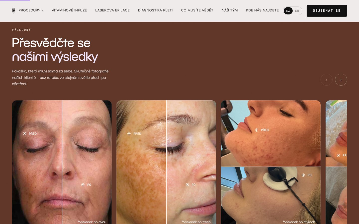 Sekce s výsledky na webu SkinSkin: fotografie pleti před ošetřením a po něm.